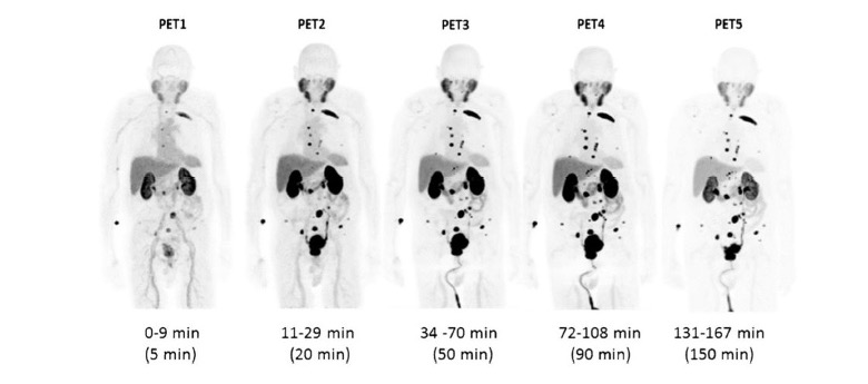 Maximum intensity PET image sequence