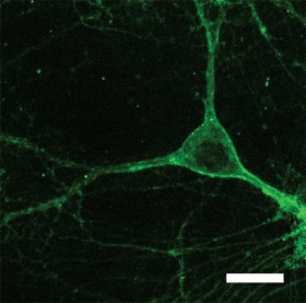 Image of Mouse Neuron Expressing Arch Gene