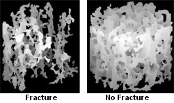 Image of Fracture and No Fracture