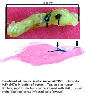 Treatment of Mouse Sciatic Nerve MPNST
