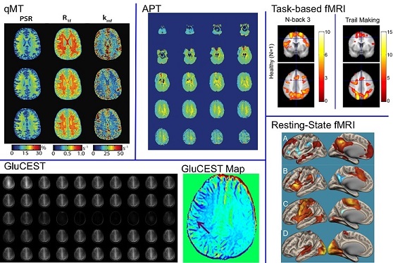  Example data for quantitative Magnetization Transfer (qMT) (PSR, R1f, kmf), Amide Proton Transfer (APT asymmetry), Task-based fMRI (NBack, Trail Making), Glutamate Chemical Exchange Saturation Transfer (GluCEST), and Resting-state fMRI for one healthy volunteer showing the range of data acquired.