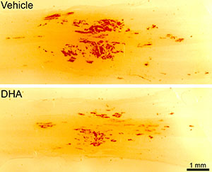 NovaRed staining was used to demonstrate a significant reduction in hemorrhage following SCI in rats treated with DHA (bottom) compared to those treated with control vehicle (top). Figure courtesy of Dr. Ping Yip.