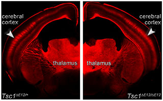 Genetic circuit tracing, which is visualized by red labeling, was used to show the connections between the thalamus and cerebral cortex in an adult mouse brain in which Tsc1 is functional (control, left) or in which both copies of Tsc1 were deleted at an early stage of development (mutant, right). Arrowheads indicate the innervation of somatosensory barrel structures in control cortex, which are less clearly delineated in mutant cortex. Courtesy of Mark Zervas.